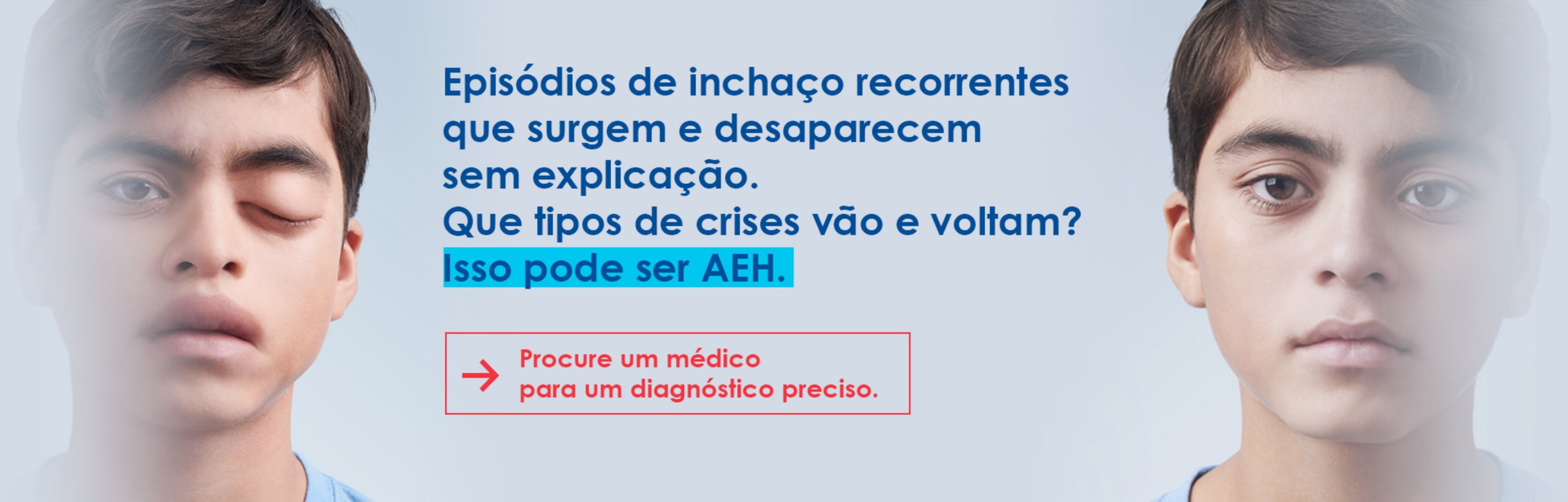 Episódios de inchaço recorrentes que sugem e desaparecem sem explicação. Que tipo de crises vão e voltam? Isso pode ser AEH